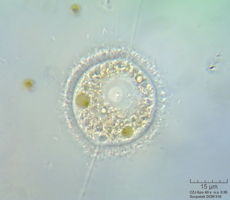 Amoeba Nuclearia   -  Nuclearia simplex